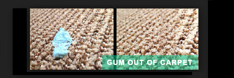 Gum Removal